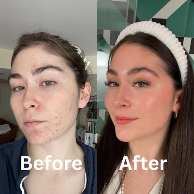 Collagen Restoration Complex Mask