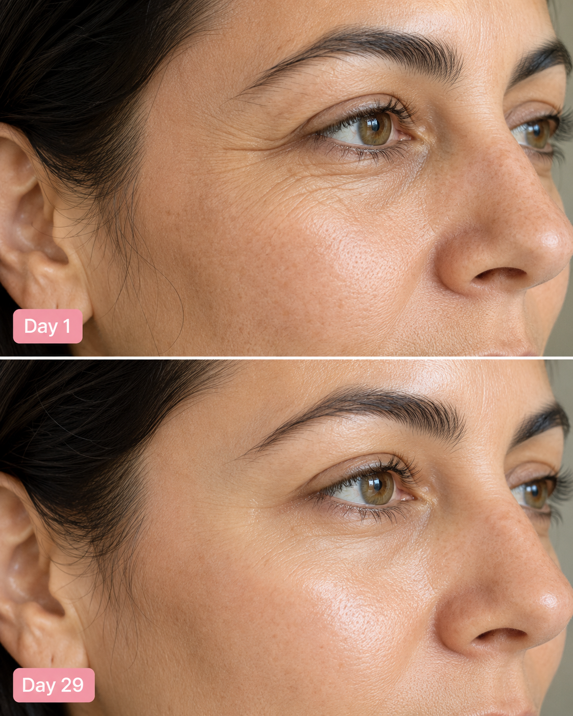 🧬 Skin Regeneration Without Injectables