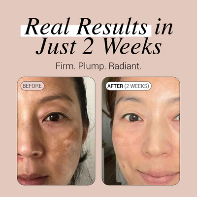 PDRN Pink Collagen Volume Multi Balm