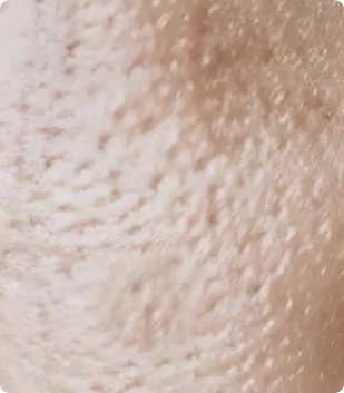 large, sagging pores